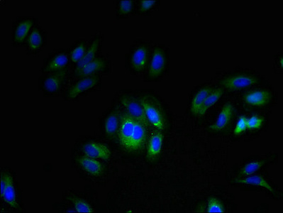 FAM70A Antibody - Immunofluorescent analysis of HepG2 cells using TMEM255A Antibody at dilution of 1:100 and Alexa Fluor 488-congugated AffiniPure Goat Anti-Rabbit IgG(H+L)