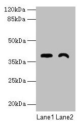 FAM70A Antibody - Western blot All lanes: TMEM255A antibody at 6µg/ml Lane 1: Mouse stomach tissue Lane 2: Mouse heart tissue Secondary Goat polyclonal to rabbit IgG at 1/10000 dilution Predicted band size: 39, 21, 36, 27 kDa Observed band size: 39 kDa