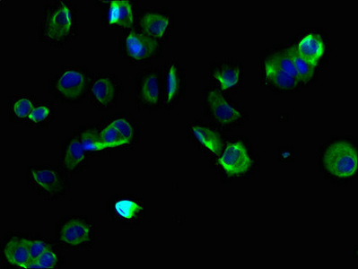 FAM70B Antibody - Immunofluorescent analysis of MCF-7 cells using TMEM255B Antibody at dilution of 1:100 and Alexa Fluor 488-congugated AffiniPure Goat Anti-Rabbit IgG(H+L)