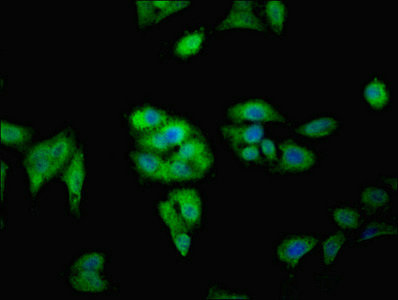 FAM71A Antibody - Immunofluorescent analysis of Hela cells using FAM71A Antibody at dilution of 1:100 and Alexa Fluor 488-congugated AffiniPure Goat Anti-Rabbit IgG(H+L)