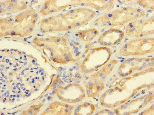 FAM71A Antibody - Immunohistochemistry of paraffin-embedded human kidney tissue using FAM71A Antibody at dilution of 1:100