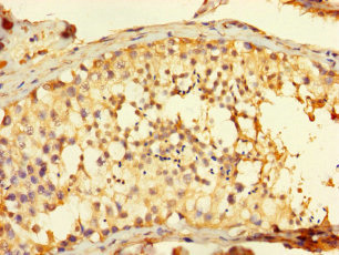 FAM71A Antibody - Immunohistochemistry of paraffin-embedded human testis tissue using FAM71A Antibody at dilution of 1:100