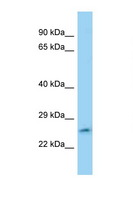 FAM71C Antibody - FAM71C antibody Western blot of Jurkat Cell lysate. Antibody concentration 1 ug/ml.  This image was taken for the unconjugated form of this product. Other forms have not been tested.