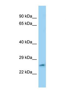 FAM71C Antibody - FAM71C antibody Western blot of Jurkat Cell lysate. Antibody concentration 1 ug/ml.  This image was taken for the unconjugated form of this product. Other forms have not been tested.