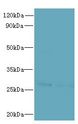 FAM71C Antibody - Western blot. All lanes: FAM71C antibody at 6 ug/ml. Lane 1: 293T whole cell lysate. Lane 2: Jurkat whole cell lysate. Secondary Goat polyclonal to Rabbit IgG at 1:10000 dilution. Predicted band size: 27 kDa. Observed band size: 27 kDa.