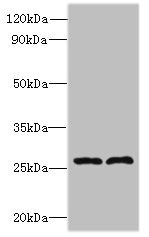 FAM71C Antibody - Western blot All lanes: FAM71C antibody at 6µg/ml Lane 1: 293T whole cell lysate Lane 2: Jurkat whole cell lysate Secondary Goat polyclonal to rabbit IgG at 1/10000 dilution Predicted band size: 28 kDa Observed band size: 28 kDa