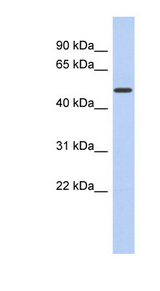 FAM71D Antibody - FAM71D antibody Western blot of Fetal Kidney lysate. This image was taken for the unconjugated form of this product. Other forms have not been tested.
