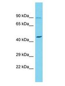FAM73A Antibody - FAM73A antibody Western Blot of OVCAR-3. Antibody dilution: 1 ug/ml.  This image was taken for the unconjugated form of this product. Other forms have not been tested.