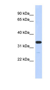 FAM76A Antibody - FAM76A antibody Western blot of MCF7 cell lysate. This image was taken for the unconjugated form of this product. Other forms have not been tested.