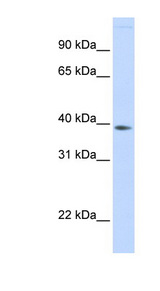 FAM76B Antibody - FAM76B antibody Western blot of Fetal Liver lysate. This image was taken for the unconjugated form of this product. Other forms have not been tested.