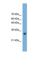 FAM78A Antibody - FAM78A antibody Western blot of Transfected 293T cell lysate. This image was taken for the unconjugated form of this product. Other forms have not been tested.