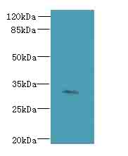 FAM78A Antibody - Western blot. All lanes: FAM78A antibody at 0.2 ug/ml+Heo-2 whole cell lysate Goat polyclonal to rabbit at 1:10000 dilution. Predicted band size: 32 kDa. Observed band size: 32 kDa.