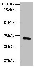 FAM78A Antibody - Western blot All lanes: FAM78A antibody at 0.2µg/ml + HepG2 whole cell lysate Secondary Goat polyclonal to rabbit IgG at 1/10000 dilution Predicted band size: 32 kDa Observed band size: 32 kDa