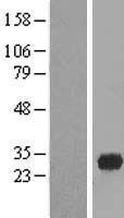 FAM78A Protein - Western validation with an anti-DDK antibody * L: Control HEK293 lysate R: Over-expression lysate