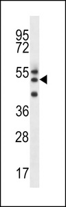 FAM82A1 Antibody - RMD2 Antibody western blot of uterus tumor cell line lysates (35 ug/lane). The RMD2 antibody detected the RMD2 protein (arrow).