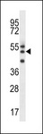 FAM82A1 Antibody - RMD2 Antibody western blot of uterus tumor cell line lysates (35 ug/lane). The RMD2 antibody detected the RMD2 protein (arrow).