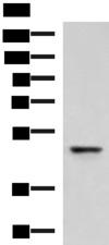 FAM82A1 Antibody - Western blot analysis of Human fetal liver tissue lysate  using RMDN2 Polyclonal Antibody at dilution of 1:750