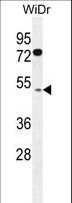 FAM82B Antibody - RMD1 Antibody western blot of WiDr cell line lysates (35 ug/lane). The RMD1 antibody detected the RMD1 protein (arrow).