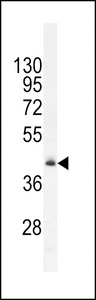 FAM82B Antibody - RMD1 Antibody western blot of mouse heart tissue lysates (35 ug/lane). The RMD1 antibody detected the RMD1 protein (arrow).