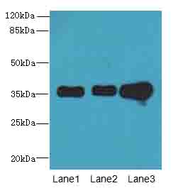 FAM82B Antibody - Western blot. All lanes: RMDN1 antibody at 0.6 ug/ml. Lane 1: K562 whole cell lysate. Lane 2: HepG-2 whole cell lysate. Lane 3: MCF7 whole cell lysate. Secondary Goat polyclonal to Rabbit IgG at 1:10000 dilution. Predicted band size: 36 kDa. Observed band size: 36 kDa.