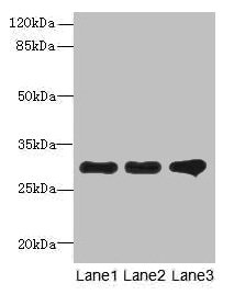FAM82B Antibody - Western blot All lanes: RMDN1 antibody at 0.6µg/ml Lane 1: K562 whole cell lysate Lane 2: HepG2 whole cell lysate Lane 3: MCF-7 whole cell lysate Secondary Goat polyclonal to rabbit IgG at 1/10000 dilution Predicted band size: 36, 33, 31 kDa Observed band size: 31 kDa