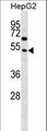 FAM83A Antibody - FAM83A Antibody (D283) western blot of HepG2 cell line lysates (35 ug/lane). The FAM83A antibody detected the FAM83A protein (arrow).
