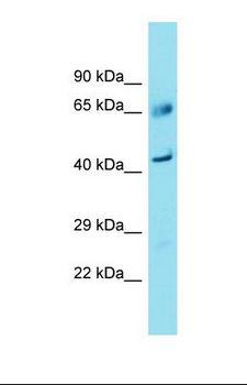 FAM83A Antibody - Western blot of Fetal Liver. FAM83A antibody dilution 1.0 ug/ml.  This image was taken for the unconjugated form of this product. Other forms have not been tested.