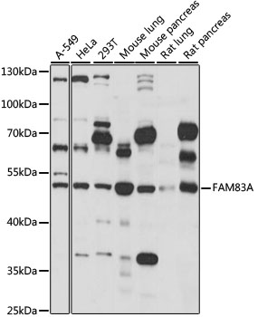 FAM83A Antibody - Western blot analysis of extracts of various cell lines, using FAM83A antibody at 1:1000 dilution. The secondary antibody used was an HRP Goat Anti-Rabbit IgG (H+L) at 1:10000 dilution. Lysates were loaded 25ug per lane and 3% nonfat dry milk in TBST was used for blocking. An ECL Kit was used for detection and the exposure time was 15s.
