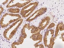 FAM83C Antibody - Immunochemical staining of human FAM83C in human prostate with rabbit polyclonal antibody at 1:500 dilution, formalin-fixed paraffin embedded sections.