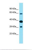 FAM83D Antibody - Western blot of Fetal Lung. FAM83D antibody dilution 1.0 ug/ml.  This image was taken for the unconjugated form of this product. Other forms have not been tested.