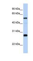 FAM83F Antibody - FAM83F antibody Western blot of Fetal Brain lysate. This image was taken for the unconjugated form of this product. Other forms have not been tested.