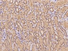 FAM83F Antibody - Immunochemical staining of human FAM83F in human kidney with rabbit polyclonal antibody at 1:100 dilution, formalin-fixed paraffin embedded sections.