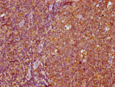 FAM83G Antibody - Immunohistochemistry Dilution at 1:400 and staining in paraffin-embedded human tonsil tissue performed on a Leica BondTM system. After dewaxing and hydration, antigen retrieval was mediated by high pressure in a citrate buffer (pH 6.0). Section was blocked with 10% normal Goat serum 30min at RT. Then primary antibody (1% BSA) was incubated at 4°C overnight. The primary is detected by a biotinylated Secondary antibody and visualized using an HRP conjugated SP system.