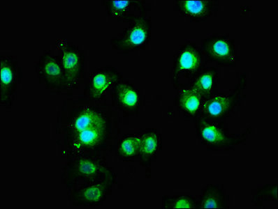 FAM83G Antibody - Immunofluorescence staining of A549 cells with FAM83G Antibody at 1:133, counter-stained with DAPI. The cells were fixed in 4% formaldehyde, permeabilized using 0.2% Triton X-100 and blocked in 10% normal Goat Serum. The cells were then incubated with the antibody overnight at 4°C. The secondary antibody was Alexa Fluor 488-congugated AffiniPure Goat Anti-Rabbit IgG(H+L).