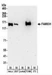 FAM83H Antibody - Detection of Human and Mouse FAM83H by Western Blot. Samples: Whole cell lysate (50 ug) from HeLa, 293T, Jurkat, mouse TCMK-1, and mouse NIH3T3 cells. Antibodies: Affinity purified rabbit anti-FAM83H antibody used for WB at 0.1 ug/ml. Detection: Chemiluminescence with an exposure time of 3 minutes.