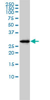 FAM84A Antibody - NSE1 monoclonal antibody (M01), clone 1C2 Western blot of NSE1 expression in HL-60.