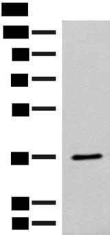 FAM84A Antibody - Western blot analysis of Mouse small intestines tissue lysate  using FAM84A Polyclonal Antibody at dilution of 1:300