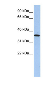 FAM84A Antibody - FAM84A antibody Western blot of HepG2 cell lysate. This image was taken for the unconjugated form of this product. Other forms have not been tested.