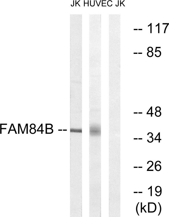 FAM84B Antibody - Western blot analysis of lysates from Jurkat and HUVEC cells, using FAM84B Antibody. The lane on the right is blocked with the synthesized peptide.