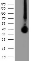 FAM84B Antibody - HEK293T cells were transfected with the pCMV6-ENTRY control (Left lane) or pCMV6-ENTRY FAM84B (Right lane) cDNA for 48 hrs and lysed. Equivalent amounts of cell lysates (5 ug per lane) were separated by SDS-PAGE and immunoblotted with anti-FAM84B.
