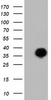 FAM84B Antibody - HEK293T cells were transfected with the pCMV6-ENTRY control (Left lane) or pCMV6-ENTRY FAM84B (Right lane) cDNA for 48 hrs and lysed. Equivalent amounts of cell lysates (5 ug per lane) were separated by SDS-PAGE and immunoblotted with anti-FAM84B.