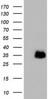 FAM84B Antibody - HEK293T cells were transfected with the pCMV6-ENTRY control (Left lane) or pCMV6-ENTRY FAM84B (Right lane) cDNA for 48 hrs and lysed. Equivalent amounts of cell lysates (5 ug per lane) were separated by SDS-PAGE and immunoblotted with anti-FAM84B.