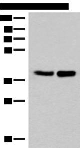 FAM84B Antibody - Western blot analysis of HUVEC and PC3 cell lysates  using FAM84B Polyclonal Antibody at dilution of 1:400