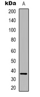 FAM84B Antibody - Western blot analysis of FAM84B expression in HUVEC (A) whole cell lysates.