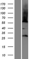 FAM86B1 Protein - Western validation with an anti-DDK antibody * L: Control HEK293 lysate R: Over-expression lysate