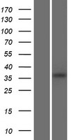 FAM86B2 Protein - Western validation with an anti-DDK antibody * L: Control HEK293 lysate R: Over-expression lysate