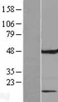 FAM86C1 Protein - Western validation with an anti-DDK antibody * L: Control HEK293 lysate R: Over-expression lysate