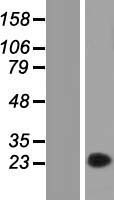 FAM89A Protein - Western validation with an anti-DDK antibody * L: Control HEK293 lysate R: Over-expression lysate