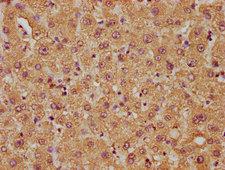 FAM89B Antibody - IHC image of FAM89B Antibody diluted at 1:50 and staining in paraffin-embedded human liver tissue performed on a Leica BondTM system. After dewaxing and hydration, antigen retrieval was mediated by high pressure in a citrate buffer (pH 6.0). Section was blocked with 10% normal goat serum 30min at RT. Then primary antibody (1% BSA) was incubated at 4°C overnight. The primary is detected by a biotinylated secondary antibody and visualized using an HRP conjugated SP system.