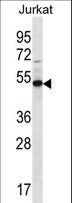 FAM8A1 Antibody - FA8A1 Antibody western blot of Jurkat cell line lysates (35 ug/lane). The FA8A1 antibody detected the FA8A1 protein (arrow).